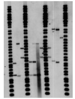 RFLP-type DNA fingerprint
